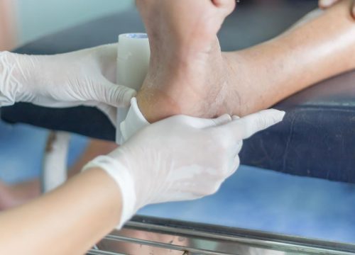 Doctor wrapping up a patient's foot/heel