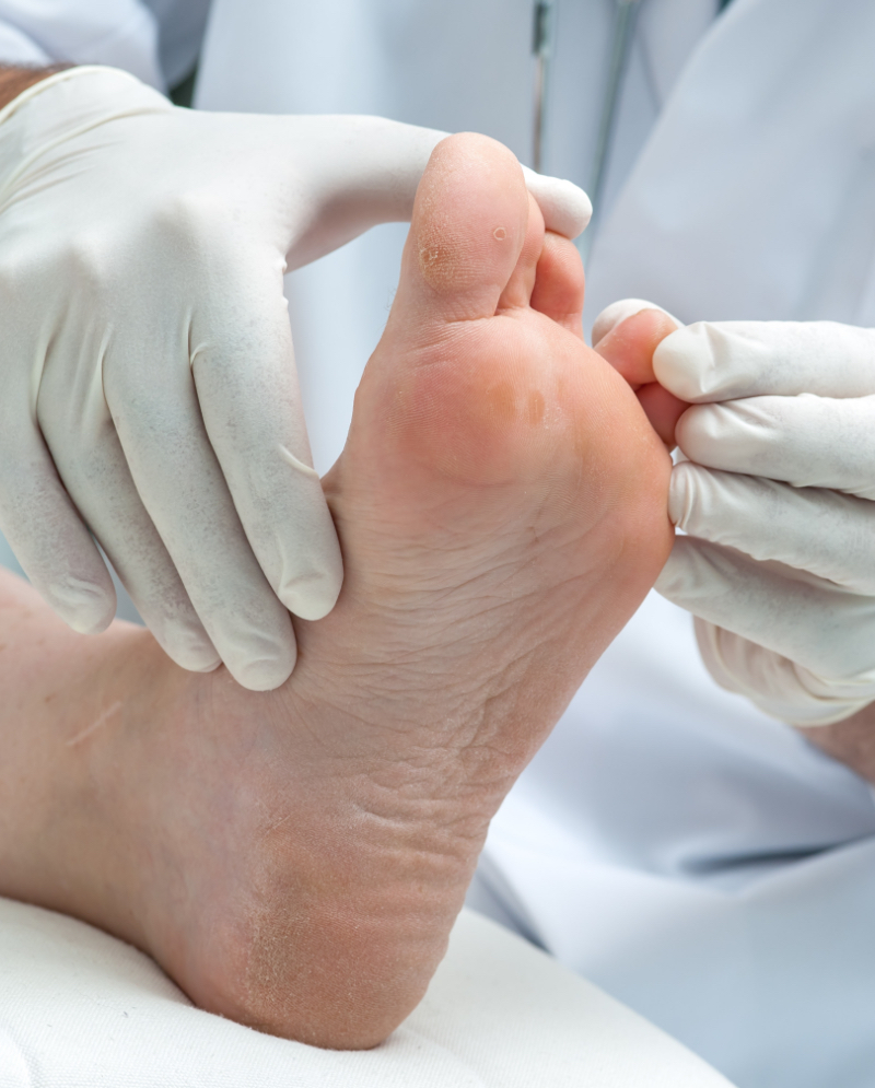Doctor checking patient's foot for athlete's foot