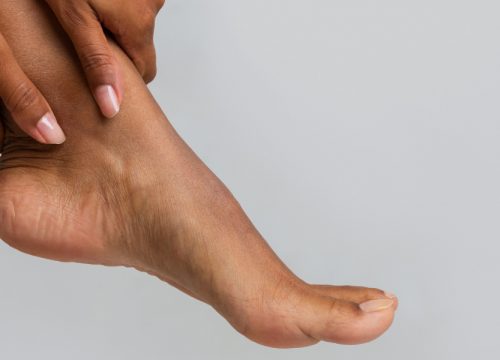 Profile of a woman's foot