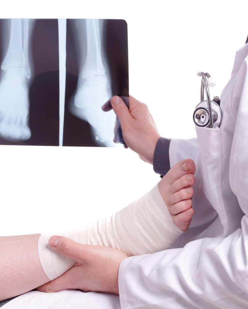 Doctor holding an ankle surgery patient's foot