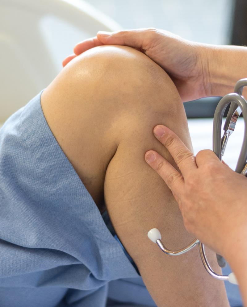 Doctor checking a patient's knee