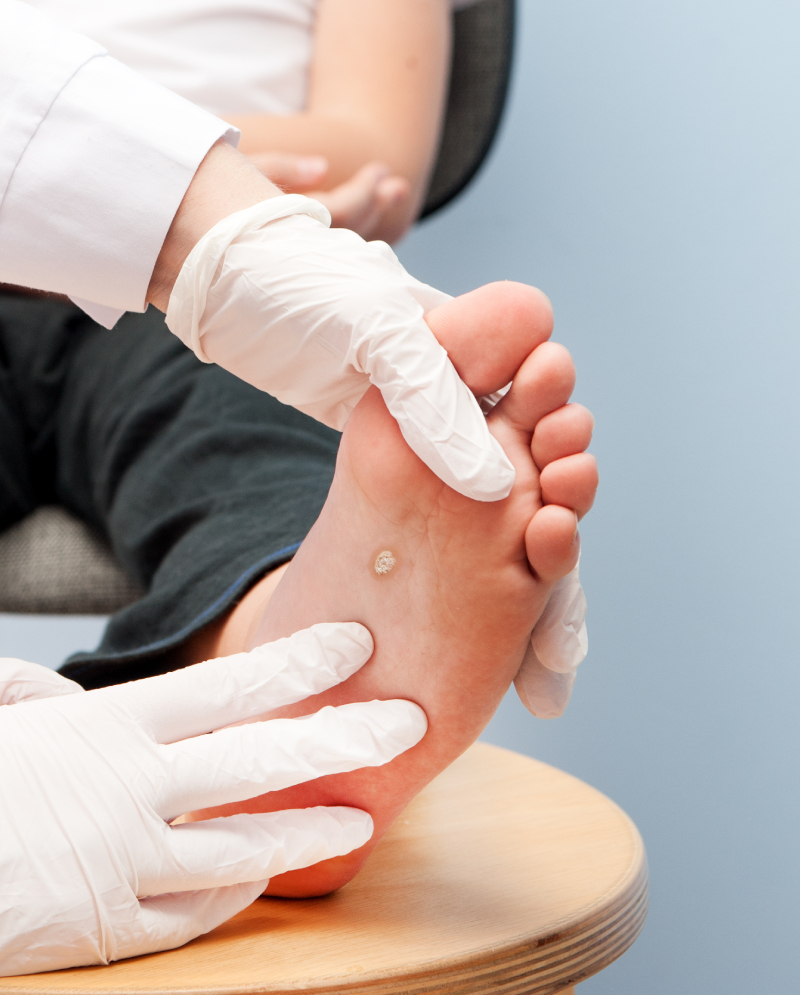 Doctor checking woman's ulcer on foot