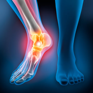 Blue x-ray representation of ankle pain