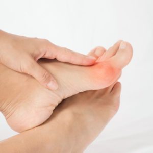 Bunion Treatment at Home