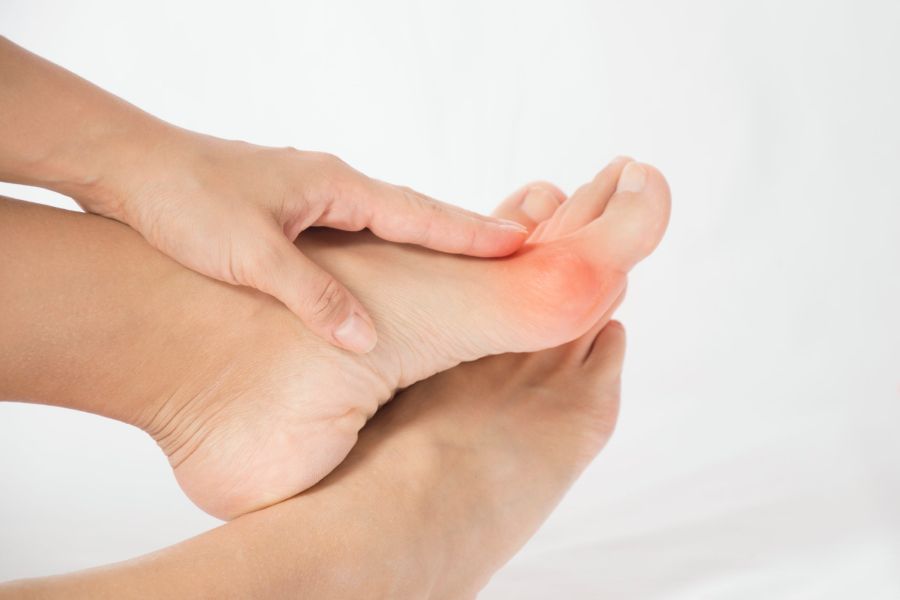 Bunion Treatment at Home