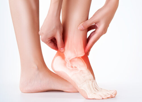 How Cortisone Shots Can Help Relieve Pain in the Legs and Feet | Beyond Podiatry