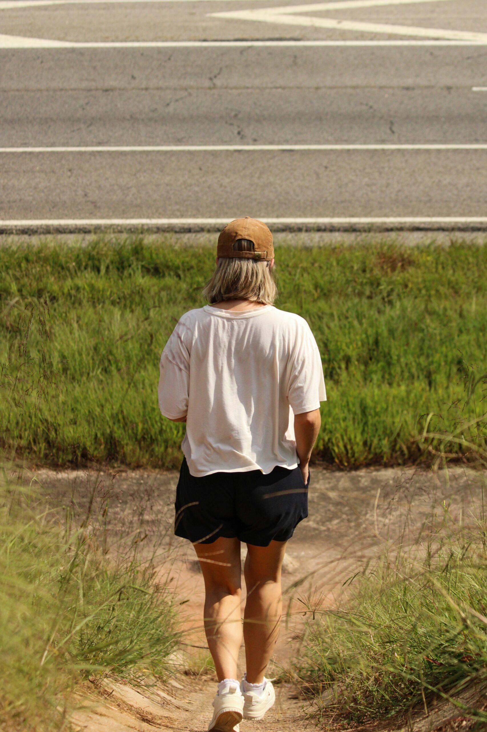 Varicose vs. Spider Veins: What’s the Difference?